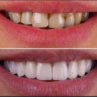 خدمات دندانپزشکی و دندانسازی