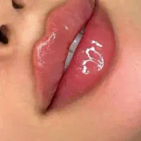 تخفیف 50 درصدی تزریق ژل و بوتاکس