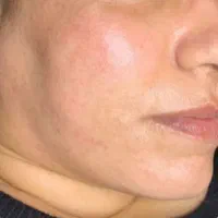 پک رفع تیرگی وضدلک|آرایشی، بهداشتی، درمانی|تهران, تهرانسر غربی|دیوار