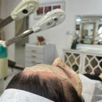 سشوار کشی +فشیال صورت رایگان