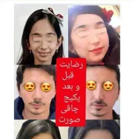 پودر جوانه گندم