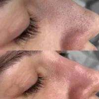 تخفیفات ویژه  لاین فیشال و پدیکوردرمانی|خدمات آرایشگری و زیبایی|رودسر, |دیوار