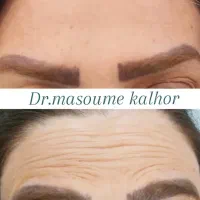 جشنواره بی سابقه بوتاکس مصپورت