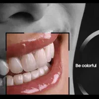 ثبت نام بیمه دندانپزشکی وکامپوزیت وزیبایی دندان