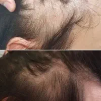 مراقبت پوست و مو|آرایشی، بهداشتی، درمانی|شیراز, طلاب|دیوار