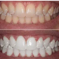 دندانپزشکی درمان ریشه ایمپلنت دکترمجید بیرانوند