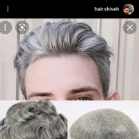 پروتز مو بافت مو ترمیم مو سجادی ارزانتر از همه جا|خدمات آرایشگری و زیبایی|تهران, جوادیه تهرانپارس|دیوار