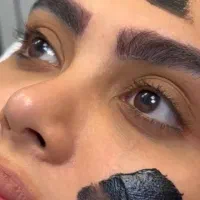 بوتاکس ژل مزوتراپی مو و صورت میکرونیدلینگ فشیال|خدمات آرایشگری و زیبایی|چهارباغ, |دیوار