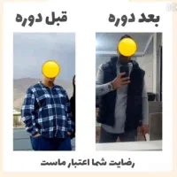 چربیسوزی فوری