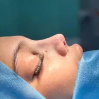 جراحی بینی ۲۴میلیون