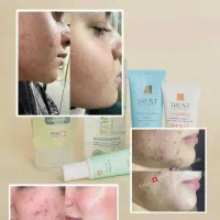 پوست خود را بامحصول تراست تجربه کنید  فاقد پارابن|آرایشی، بهداشتی، درمانی|تهران, سلسبیل جنوبی|دیوار