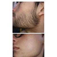 مثل انار پر و دونه دونه شو