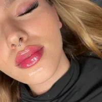 تزریق ژل (فیلر)وبوتاکس لیفت با نخ کانتورینگ