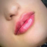 اف ویژه تمام خدمات زیبایی و جراحی در مطب|خدمات آرایشگری و زیبایی|یاسوج, |دیوار