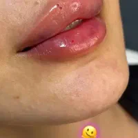 کلینیک زیبایی خدمات فیلر بوتاکس مزوژل PRP|خدمات آرایشگری و زیبایی|اهواز, کیان اباد|دیوار