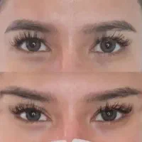 فیلر لیفت بینی و صورت وشقیقه مزوتراپی بوتاکس|خدمات آرایشگری و زیبایی|تهران, تهرانپارس جنوبی|دیوار