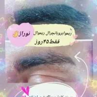 ریموتاتوصورت و بدن