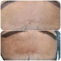 اموزشگاه ومرکز تخصصی پوست
