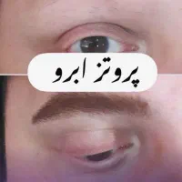 فروش پرتز ابروی ۲ ساله به فرم دلخواه شما