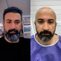 جشنواره‌کاشت‌‌مو(شیرازی)فقط۲۳تومن