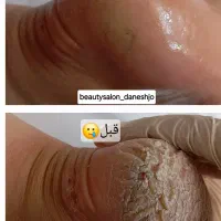 آموزش و خدمات کفسابی پا و کاشت ناخن اپیلاسیون|خدمات آرایشگری و زیبایی|ارومیه, |دیوار