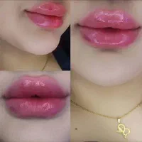 جشنواره تخفیف تزریق تخصصی ژل و بوتاکس|خدمات آرایشگری و زیبایی|شیراز, محراب|دیوار