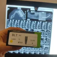 اقساط دندانپزشکی بدون پرداخت پول کلیه خدمات|خدمات آرایشگری و زیبایی|اصفهان, عطار نیشابوری|دیوار