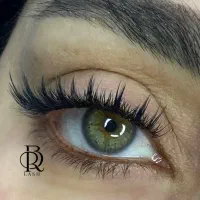 کاشت مژه هیدن ۴۰روزه