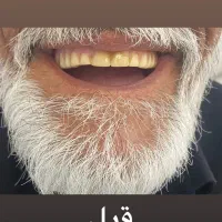 ساخت دندان مصنوعی کامل / تکه ای / تکی|پزشکی|شیراز, شهرک پرواز|دیوار