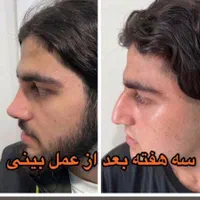 دکتر اسدالله‌پور، جراح برتر بینی در مازندران|خدمات آرایشگری و زیبایی|قائم‌شهر, |دیوار