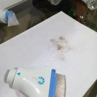 پاکسازی شپش ورشک|خدمات آرایشگری و زیبایی|سبزوار, شرق کال میانی|دیوار