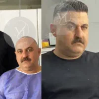 تخفیف ویژه کاشتمو