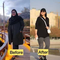 بوتاکس معده/تزریق لاغری/دستگاه لاغری|خدمات آرایشگری و زیبایی|تهران, دروس|دیوار