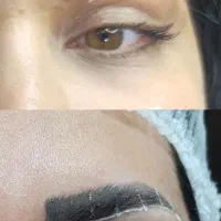 تخفیف ویژه  زمستانه عمل های  جراحی|خدمات آرایشگری و زیبایی|ارومیه, |دیوار