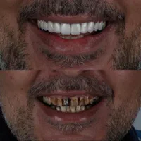 دندانپزشکی توحید.کاپوزیت،لمینت، ایمپلنت|خدمات آرایشگری و زیبایی|شیراز, فرگاز|دیوار