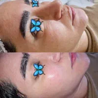 پاکسازی پوست