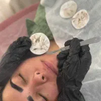 اصلاح درماپلینگ+فشیال