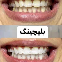 آموزش حرفه ای کار درمانی و زیبایی دندانپزشکی|خدمات آموزشی|تهران, مهرآباد جنوبی|دیوار