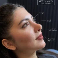جراحی بینی  ایده ال فقط با ۴۵ تومان