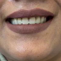 دندانسازی دندان مصنوعی در کرمان