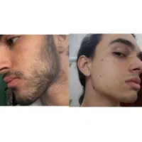 دوره پرپشتی ریش و سبیل