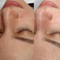 خدمات اصلاح صورت .اپیلاسیون.پاکسازی صورت|خدمات آرایشگری و زیبایی|کرمان, |دیوار