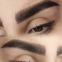 میکروبلیدینگ و شیدینگ(پیامبراعظم)