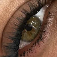 کاشت مژه هیدن ۱۵۰