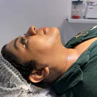 تخفیفات پیکرتراشی ابدو مامو ساکشن شکم پهلو 10 تومن
