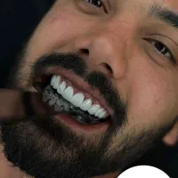 کامپوزیت دندان بلک فرایدی ویژه