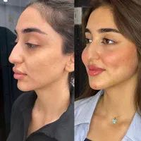 پایان جستجو کلینیک تخصصی پوست ژل 299نخ هایفوآموزش|خدمات آرایشگری و زیبایی|تهران, زعفرانیه|دیوار