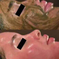 زیبایی ،پوست ،جراحی|خدمات آرایشگری و زیبایی|سهند, |دیوار