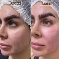 جشنواره تخفیف پلاژن، هایفو،کرایو،ام اسکالپ|خدمات آرایشگری و زیبایی|شیراز, فرهنگ شهر|دیوار