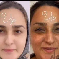 کرم سوپر معجزه